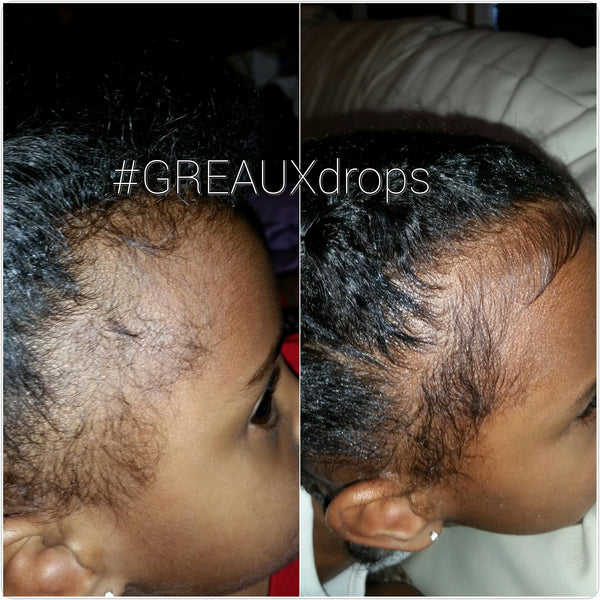 GREAUX Drops
